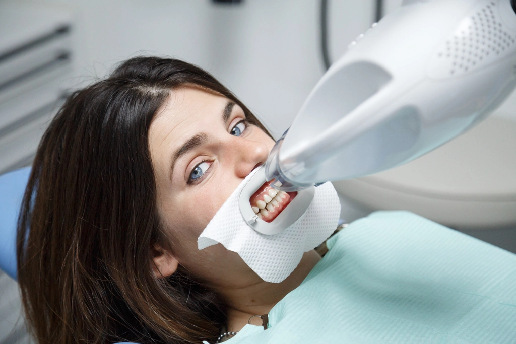 Gummy Smile Treatment